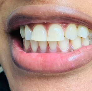 Dental Office in South San Francisco