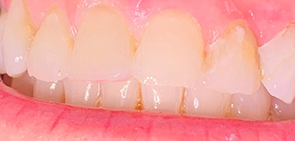 South San Francisco Cosmetic Dentist