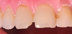 Family Dentist South San Francisco