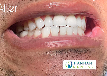 Dental Office in South San Francisco