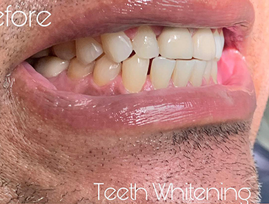 Cosmetic Dental Office South San Francisco