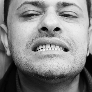 South San Francisco Cosmetic Dentist