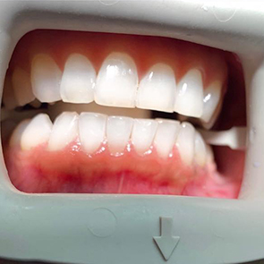 Family Dentist South San Francisco