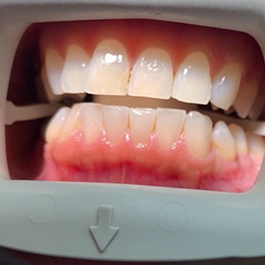 Dentist in South San Francisco