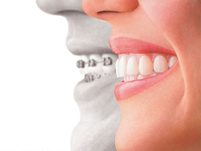 Hanhan Dental | CBCT, Oral Exams and Ceramic Crowns