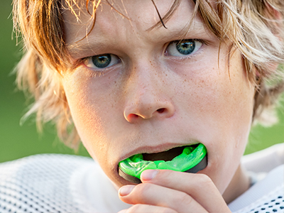 Hanhan Dental | Sports Mouthguards, All-on-6 reg  and Dentures